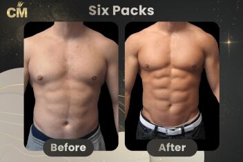 Six Packs Before After
