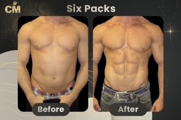 Six Packs Before After-2